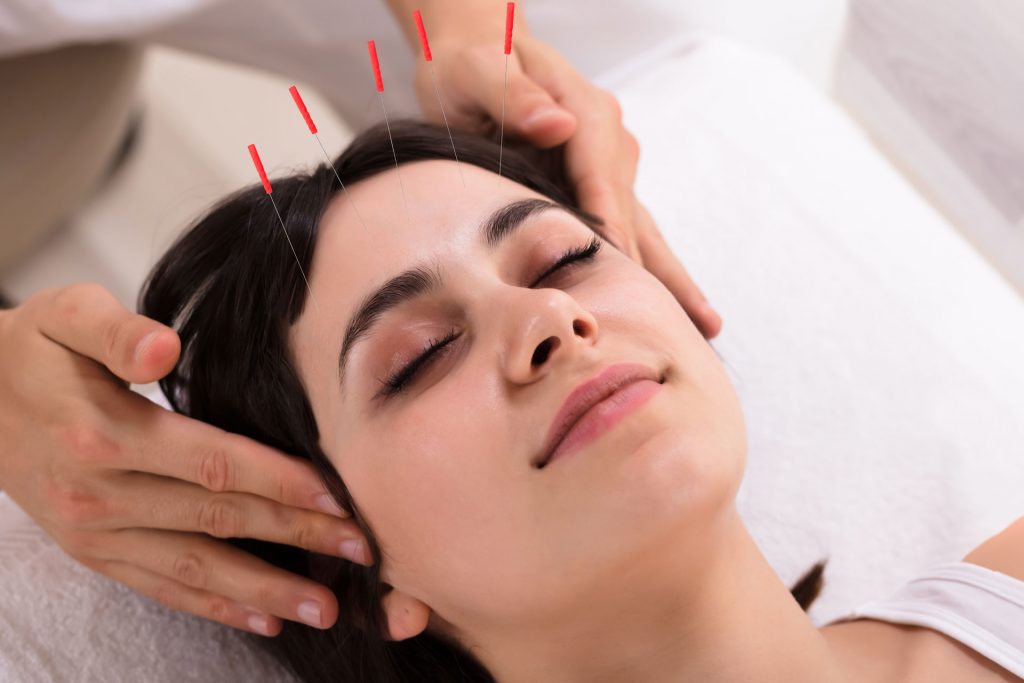 Cosmetic Acupuncture